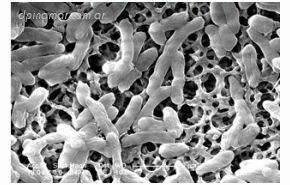 Escherichia coli bacteria